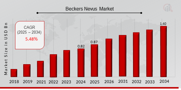 Beckers Nevus Market