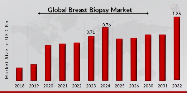 Breast Biopsy Market Overview