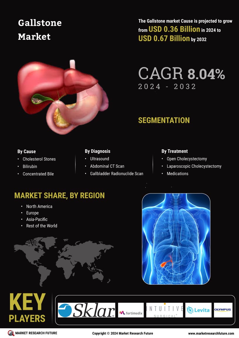 Gallstone Market