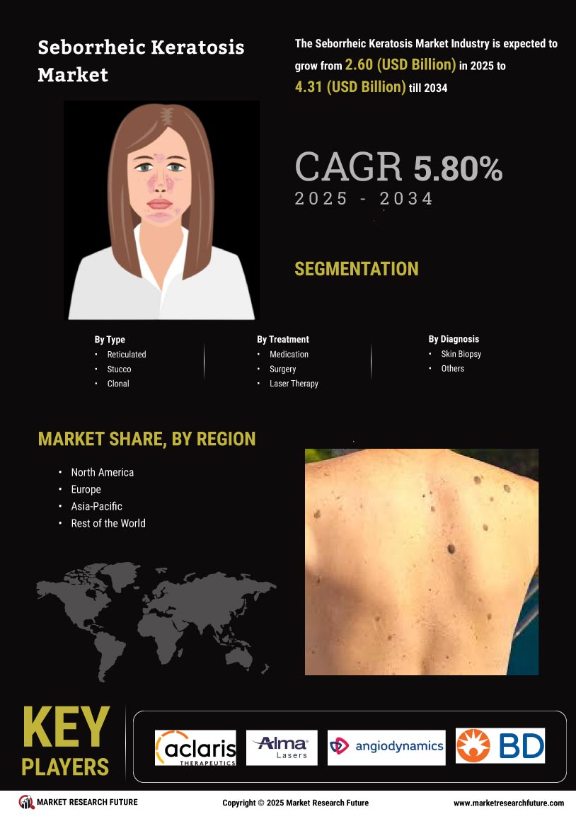 Seborrheic Keratosis Market