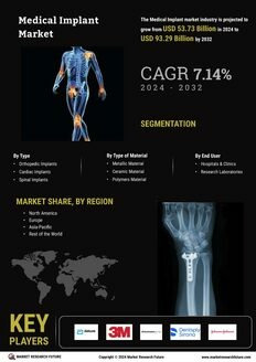 Medical Implants Market