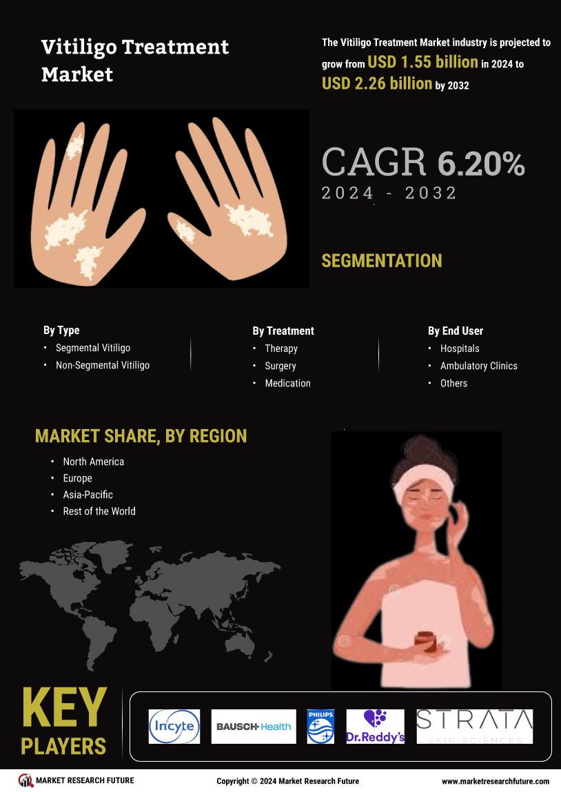 Vitiligo Treatment Market