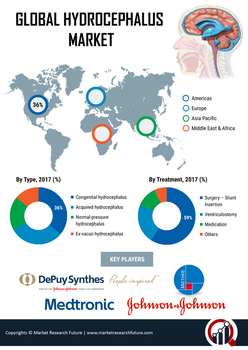 Hydrocephalus Market