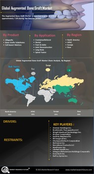 Augmented Bone Graft Market